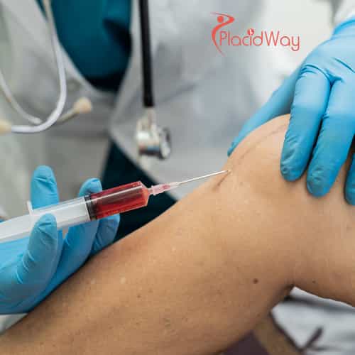 Stem Cell Treatment for Osteoarthritis: Safe, Affordable Solutions for Joint Pain